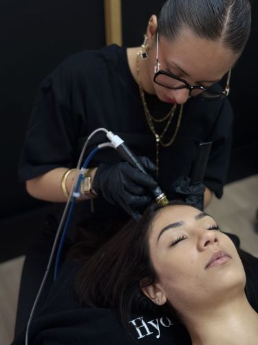 Mésothérapie capillaire