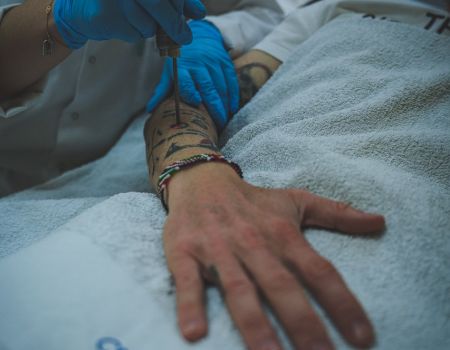 Séance de détatouage