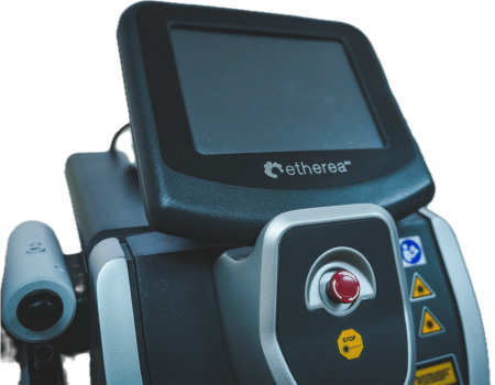 Séance de laser fractionné non ablatif