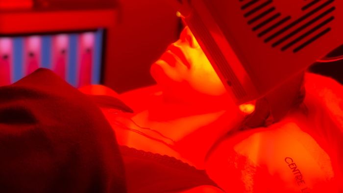 Laser vasculaire (YAG, IPL)